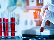 Արցախում կորոնավիրուսային հիվանդության նոր դեպքերը