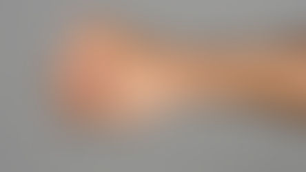 Արտառոց դեպք Երևանում. Մարզասրահի տնօրենը հարվածել է մարզիչի ամուսնու դեմքին, վերջինը հայտնվել է հիվանդանոցում