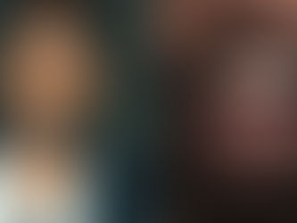 Քանյե Ուեսթը 850 հազար դոլար արժողությամբ պրոթեզ է տեղադրել եւ հայտնվել քննադատության կիզակետում