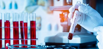 Արցախում կորոնավիրուսային հիվանդության նոր դեպքերը