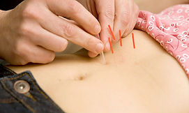 Services_Acupuncture_Slimming.jpg