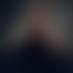 Man with tattoos thinking about removing them