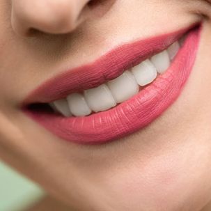 woman smiling after teeth whitening