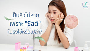 คุณผู้หญิงรู้ไหมเป็นสิวไม่หาย เพราะ "ซีสต์" ในรังไข่หรือเปล่า?