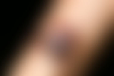 3 Things You Should Know About Lyme Disease