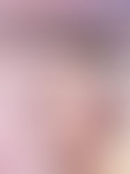 Laser Mask Technology Explained: How JOVS 4D Improves Skin Health