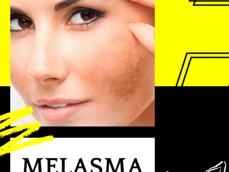 XÔ MELASMA!