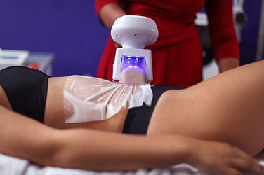 Fat Freezing