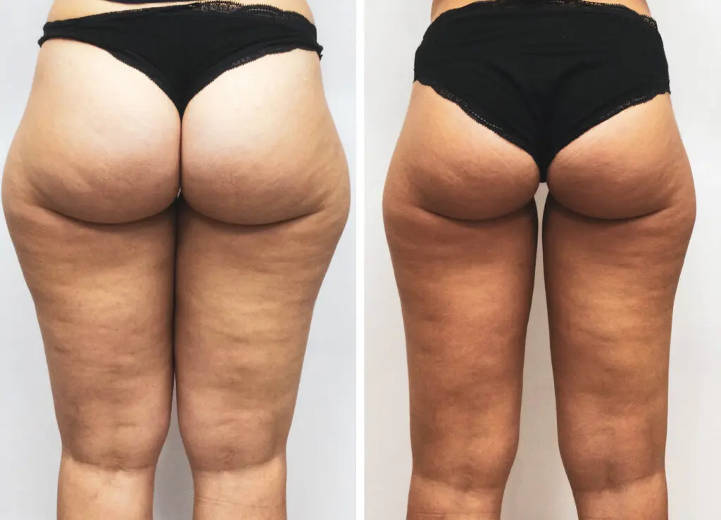 slimming mossel bay
