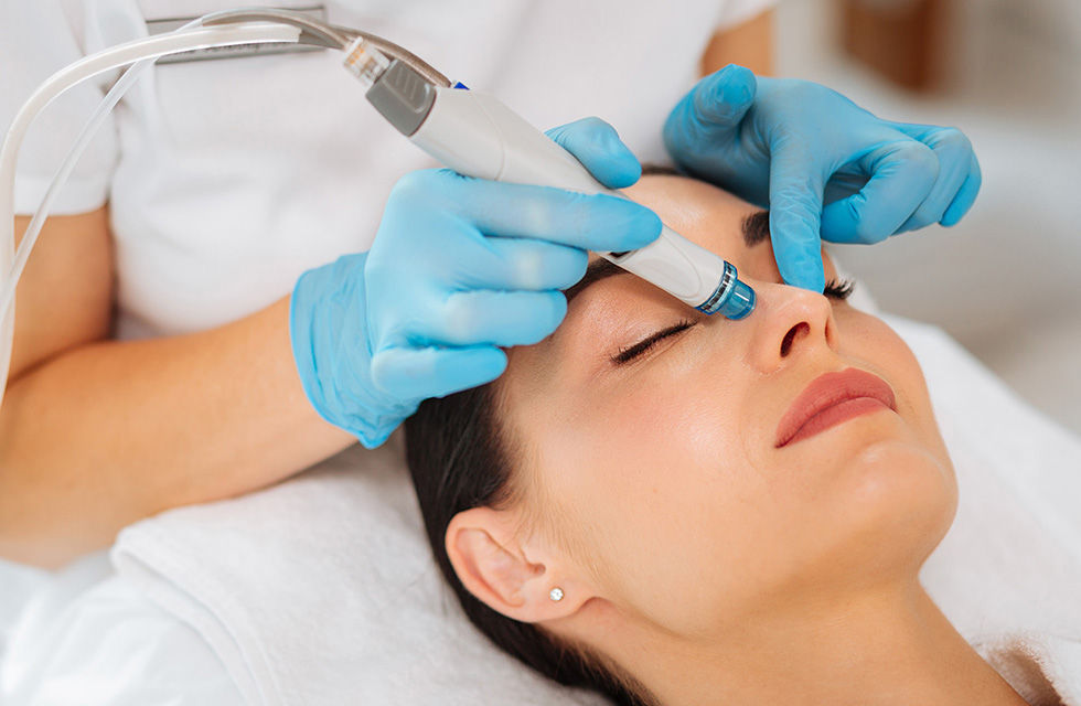 microneedling behandeling