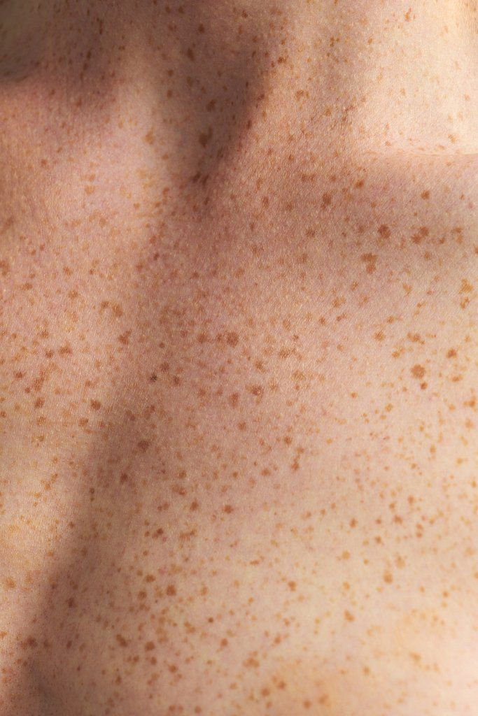 Face Glow mit vollflächig pigmentierten Sommersprossen für einen sonnengeküssten Look