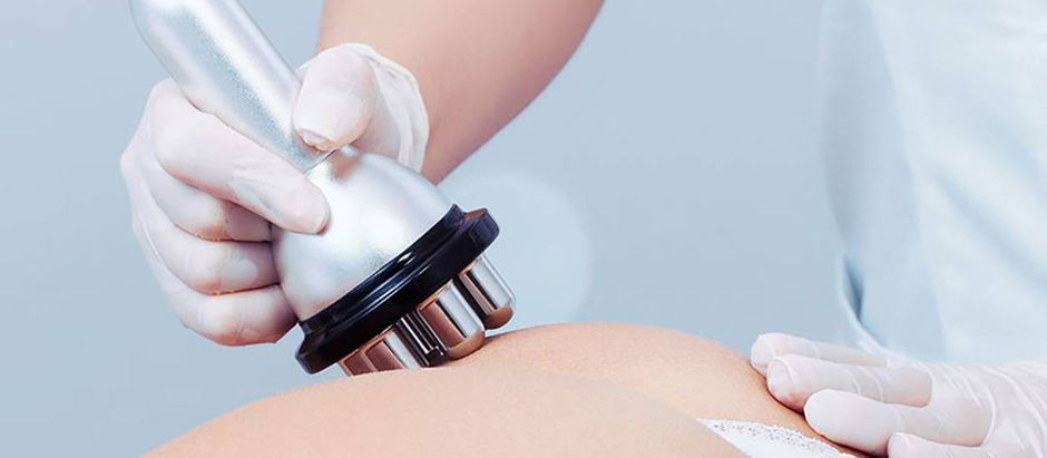 Cinco beneficios de la radiofrecuencia