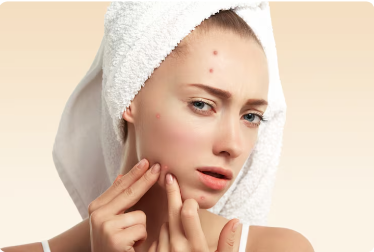 How Much Does Acne Scar Treatment Cost in Bhubaneswar?