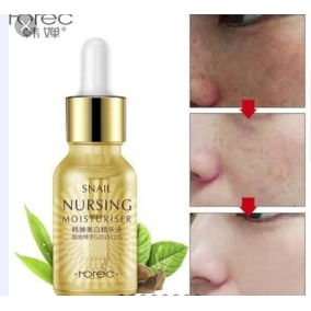 Miniatura: Snail Mticulos