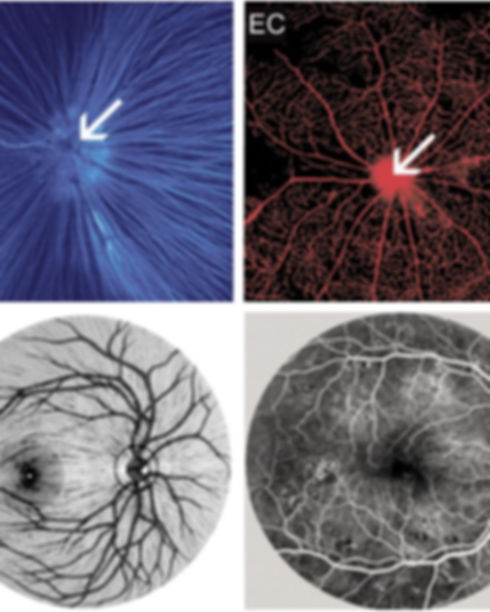 angiogenesis.jpg
