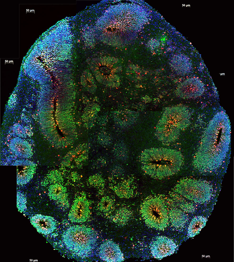 "Brain Organoid" by National Institutes of Health (NIH) is licensed under CC BY-NC 2.0.