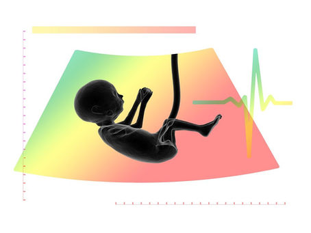 Abortion and Down Syndrome: Is it Ethically Permissible to Abort a Fetus Because it has Down Syndrome?