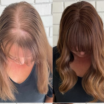 before and aftre intellimesh