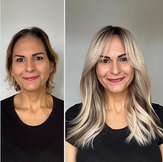 before and after Intellimesh hair loss system