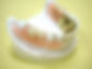 義歯
