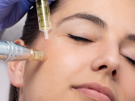 PDRN & Polynucleotide Skin Boosters: The Regenerative Treatment London Is Turning to in 2026