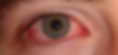 private eye emergency no text.png