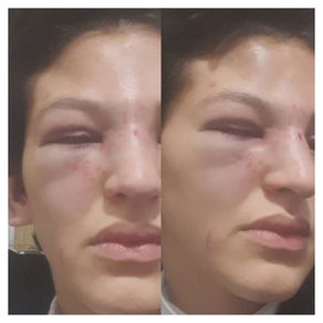 Violenta agresión a una mujer en Calilegua: denuncian a una trabajadora municipal y familiares