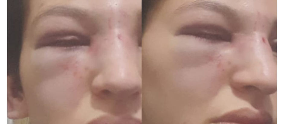 Violenta agresión a una mujer en Calilegua: denuncian a una trabajadora municipal y familiares