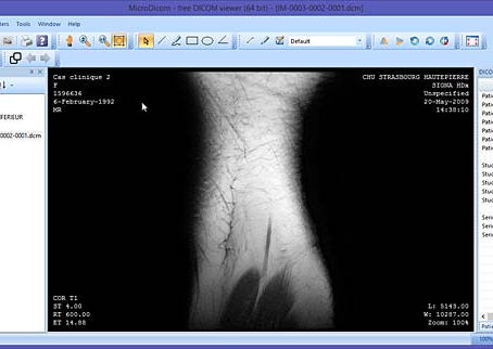 Sante CT Viewer Crack