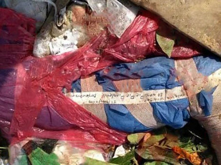 Del Hospital Carlos Canseco salió pierna amputada hallada en el basurero de Altamira