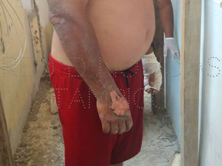 Se electrocuta en el tercer piso