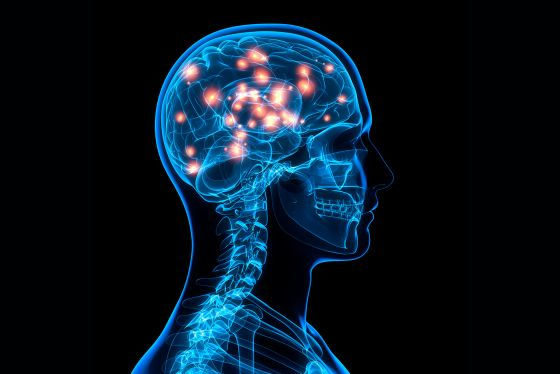 Xray image of the brain