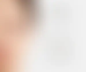 A woman closing her eyes. representing PCOS symptoms ;ole hormal imbalance, cysts, and diagnosis.