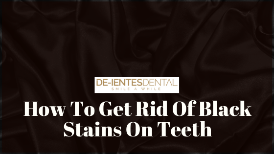 How To Get Rid Of Black Stains On Teeth