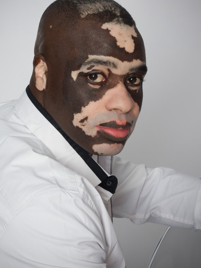 Portrait studio d’Ablaye, mannequin porteur de vitiligo, photographié sur fond blanc par le studio Colombe Photographie à Gentilly en région parisienne. Shooting portrait mettant en lumière la beauté du vitiligo et l’identité visuelle unique du modèle.