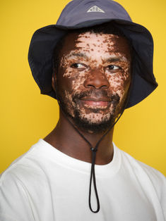 Portrait studio d’un modèle masculin avec vitiligo portant un chapeau, réalisé sur fond coloré à Gentilly en région parisienne. Idéal pour book mannequin ou comédien, ce type de photo apporte une dimension mode et créative. Colombe Photographie accompagne la création de books professionnels à Paris et en Île-de-France.