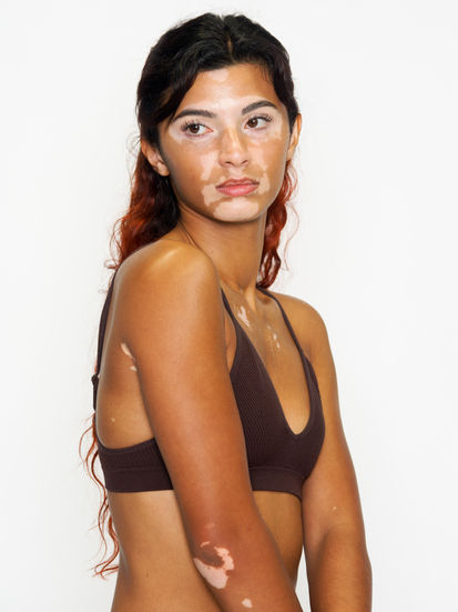 Portrait buste destiné à un book polas mannequin avec vitiligo. Cette image apporte une variation d’attitude tout en respectant les critères professionnels : lumière neutre, expression naturelle et absence de retouche corrective. Colombe Photographie accompagne les mannequins porteurs de vitiligo pour des polas professionnels à Paris.