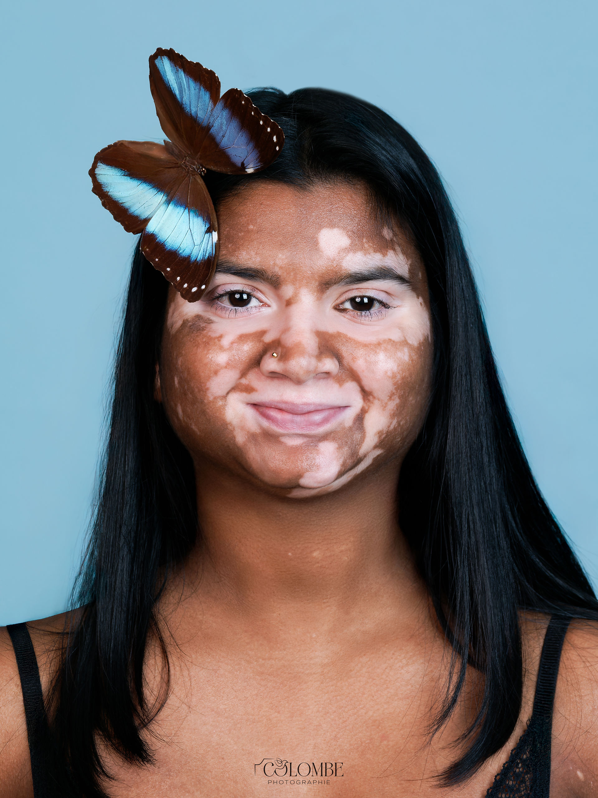 Portrait en plan serré d'Adeline de face, avec un fond bleu ciel et un papillon morpho bleu délicatement posé dans ses cheveux. Cette image fait partie d'un shooting vitiligo artistique, où l'accent est mis sur la beauté unique du visage d'Adeline et les détails subtils qui accentuent la singularité de sa peau.