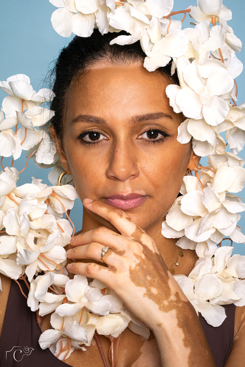Portrait serré d’Ilhame, modèle atteinte de vitiligo, entourée de fleurs blanches sur fond bleu clair. L’image met en valeur la douceur de son regard et la beauté naturelle de sa peau. Réalisée au studio Colombe Photographie à Gentilly, cette photo fait partie d’un shooting artistique sur le vitiligo, symbole d’acceptation et de confiance en soi. Photographe vitiligo à Paris, spécialisée dans les portraits artistiques et la mise en lumière de la diversité.
