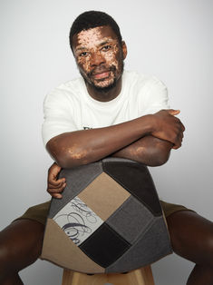 Portrait assis d’un modèle masculin porteur de vitiligo en studio photo à Gentilly. Une pose naturelle idéale pour un book comédien ou mannequin en Île-de-France, mettant en valeur la posture et la personnalité. Colombe Photographie réalise des séances studio professionnelles à Paris pour tous types de profils.