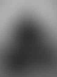 Portrait artistique photographié au studio Colombe Photographie à Gentilly, près de Paris. Cette séance photo autour du pityriasis versicolor mêle sobriété, expression et esthétique éditoriale dans une approche humaine et authentique du portrait. Studio spécialisé dans les portraits confiance en soi et les projets autour des différences visibles de peau en région parisienne.