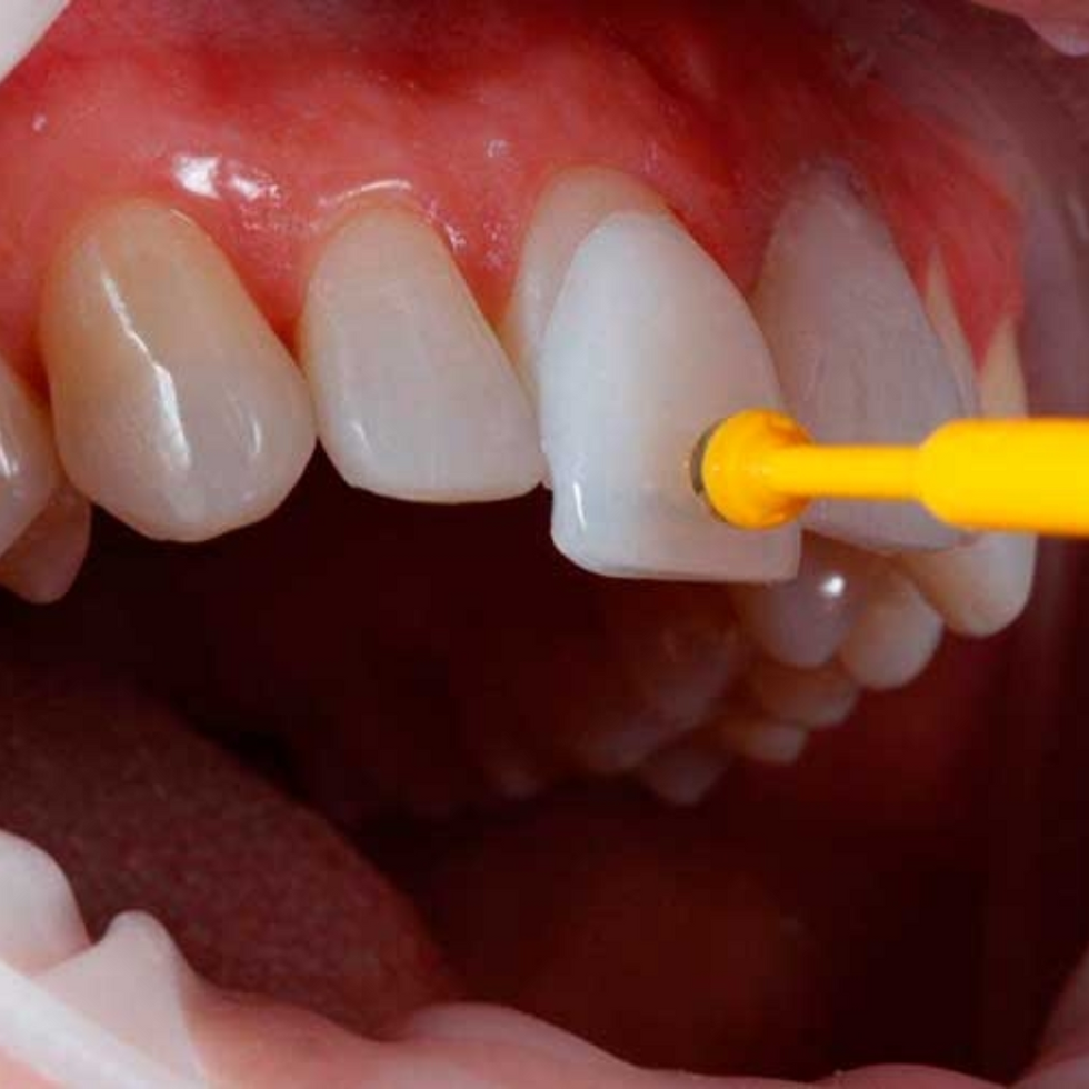 Dentalfix (15)