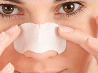 10 Home Remedies for Blackheads