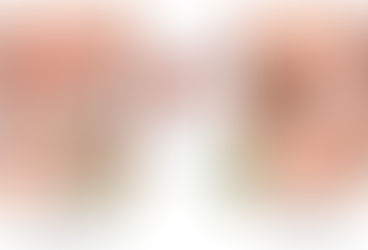 ADVANTAGES AND DISADVANTAGES OF LAPAROSCOPIC SURGERY