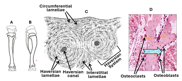 Fig. K17. Illustration A shows elongation of a long bone that was brought about by the growth and ossification of the epiphyseal plate, whereas Illustration B shows the change in shape of a long bone brought about by remodeling. Illustration C shows the histological features of a remodeled secondary bone with Haversian systems and the three different types of lamellae. Micrograph D is an H&E-stained histological section of spongy bone during remodeling. The trabecula is being eroded from the left side by osteoclasts and the same time osteoblasts are laying down new bone tissue on its right surface. The joint work of osteoclasts and osteoblasts move the trabecula rightwards (the arrow).