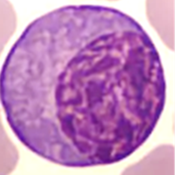 Fig. B8. The appearance of heterochromatin and euchromatin under the light microscope in a routinely stained section. Heterochromatin appears as dark purplish clumps whereas euchromatin appears as pale areas between theses heterochromatin clumps.