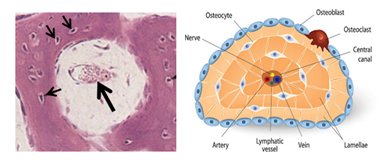 Fig. K14. The H&E section on the left shows a developing Haversian system. It has a wide central canal occupied by mesenchyme containing a blood vessel (large arrow) surrounded by woven bone containing osteocytes in lacuna (small arrows). The illustration on the right shows a mature Haversian system (osteon) with a narrow central canal containing blood vessels, lymphatics and nerves. Concentric lamellae and bone cells are shown.