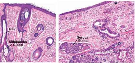 Fig. Q3. H&E-stained sections of the vestibular mucosa. The epithelium of anterior vestibular region (left) is stratified squamous keratinized, posterior region it is stratified squamous non-keratinized. The anterior region contains hair with sebaceous glands and posterior is devoid of hair and contains serous glands.