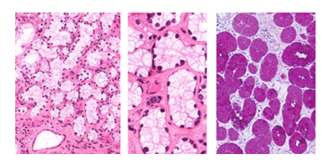 Fig. P21. Three histological sections of the lingual salivary gland. The glands mucous acini appear pale in H&E-stained sections and dark magenta-colored in the PAS-stained section (left); they positive for mucopolysaccharides.