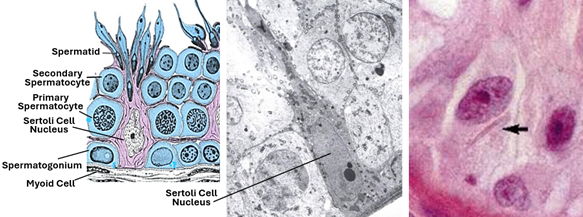 Fig. T5. The illustration (left) and the electron micrograph (middle) show Sertoli cells are transepithelial cells extending from the basal lamina to the luminal surface. They possess pale basally located nuclei and numerous cytoplasmic organelles. Sertoli cells are flanked on both side by spermatogenic cells at various stages of development. The H&E-stained section (right) shows the characteristic Charcot-Butcher body (arrow).